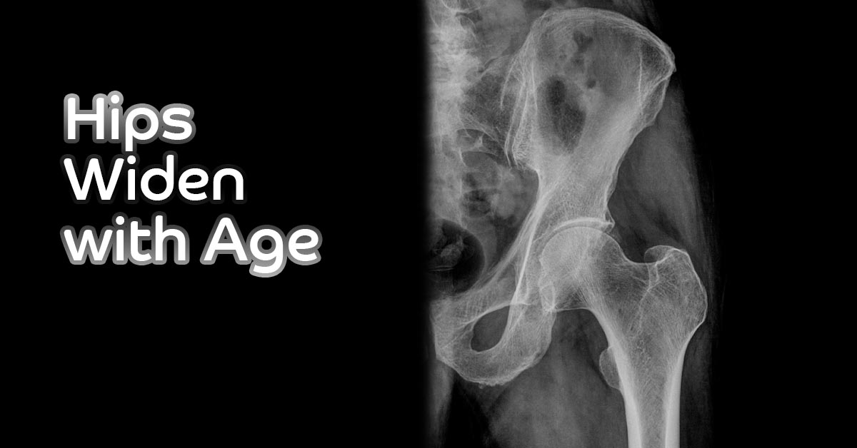  The Hidden Truth – Hips Widen with Age 